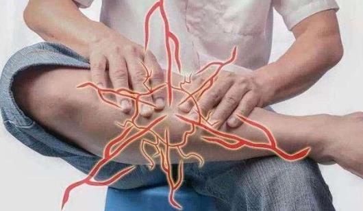 腳抽筋嚴重嗎?抽筋對身體的傷害