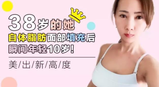沈陽杏林整形醫院自體脂肪填充案例