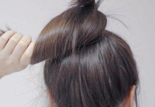 補充哪些營養可以生發?哪些疾病會引起脫發?