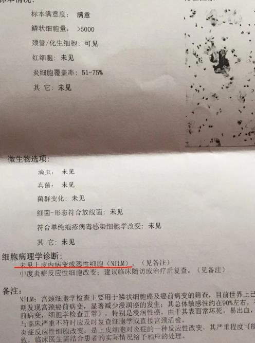 3個(gè)高危1個(gè)低危HPV感染,轉(zhuǎn)陰經(jīng)歷分享給大家