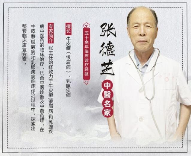 中醫張德芝:為什么會患上牛皮癬,牛皮癬原因