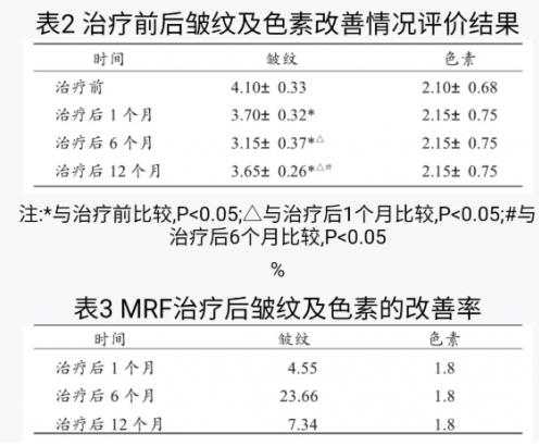近20年臨床數據認證,熱瑪吉抗衰實力不是蓋的!