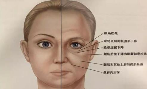京典麗園去眼袋認(rèn)為:眼袋如果放任不管,加重眼袋下垂!