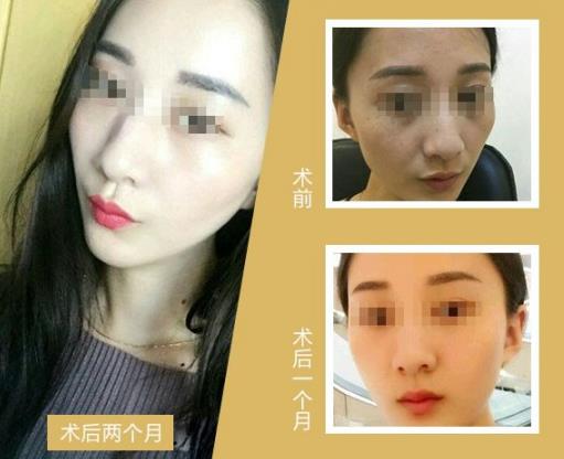 蜂巢皮秒祛斑是什么原理?江門(mén)夢(mèng)想整形醫(yī)院電話,江門(mén)夢(mèng)想整形技術(shù)好嗎