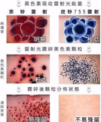 蜂巢皮秒祛斑是什么原理?江門(mén)夢(mèng)想整形醫(yī)院電話,江門(mén)夢(mèng)想整形技術(shù)好嗎