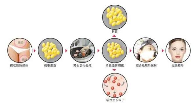 云南銅雀臺整形趙蘭明主任脂肪填充如何 專業提供整形美容服務
