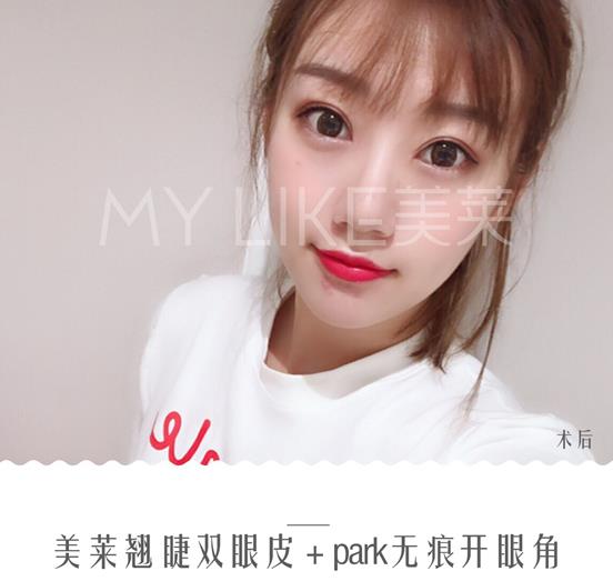 鄭州美萊醫療美容醫院正規嗎 正規靠譜 為你定制自然美眼