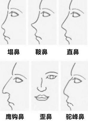 云南銅雀臺整形醫院左萬昌主任 面診隆鼻前該了解的干貨