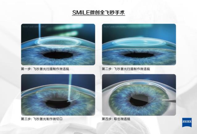 近視考生填報專業很吃虧?!鄭州尖峰眼科醫院助你摘鏡圓夢