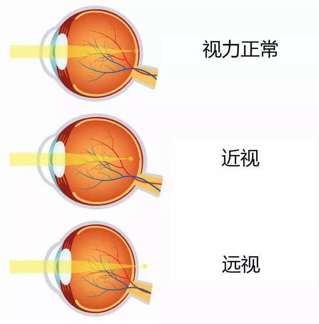 2021征兵即將開始 鄭州尖峰眼科助您實現軍旅夢