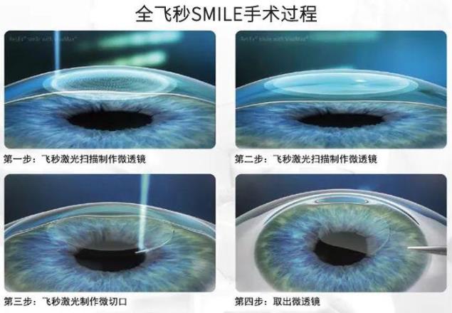 2021征兵即將開始 鄭州尖峰眼科助您實現軍旅夢