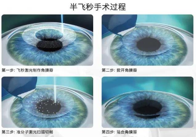 2021征兵即將開始 鄭州尖峰眼科助您實現軍旅夢