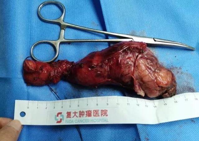 廣州好的腫瘤醫院在哪里暨南大學附屬復大腫瘤醫院