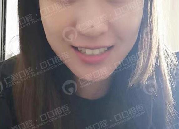 年齡大了還能矯正嗎?武漢仁愛口腔醫(yī)師告訴你可以