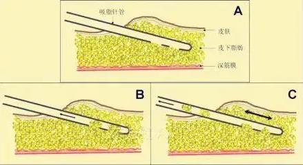 深圳悅美莉醫療門診部口碑怎么樣 誠信行醫溫馨服務