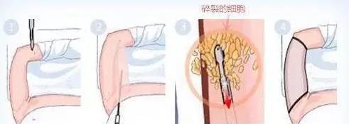 深圳悅美莉醫療門診部口碑怎么樣 誠信行醫溫馨服務
