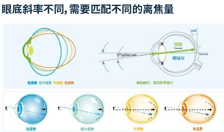 全視護丨青少年近視防控好幫手