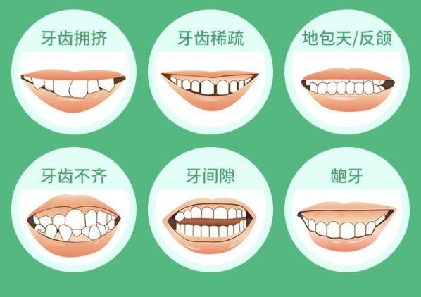 武漢德韓口腔矯正貴嗎?暑期限時拼團活動開啟