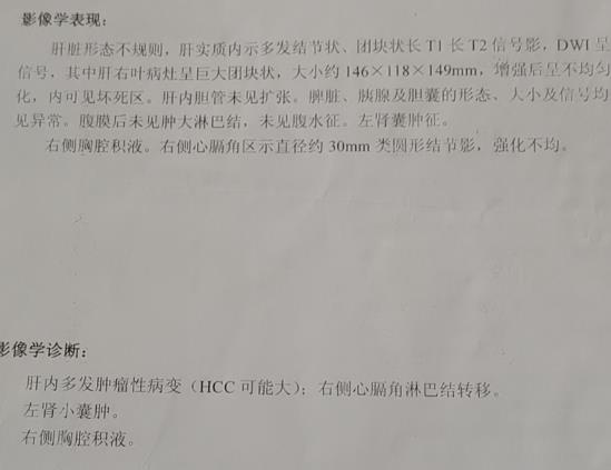 在線等-印度瑞戈非尼效果到底怎么樣啊?買一盒瑞戈非尼價格中國和印度為何不一樣?