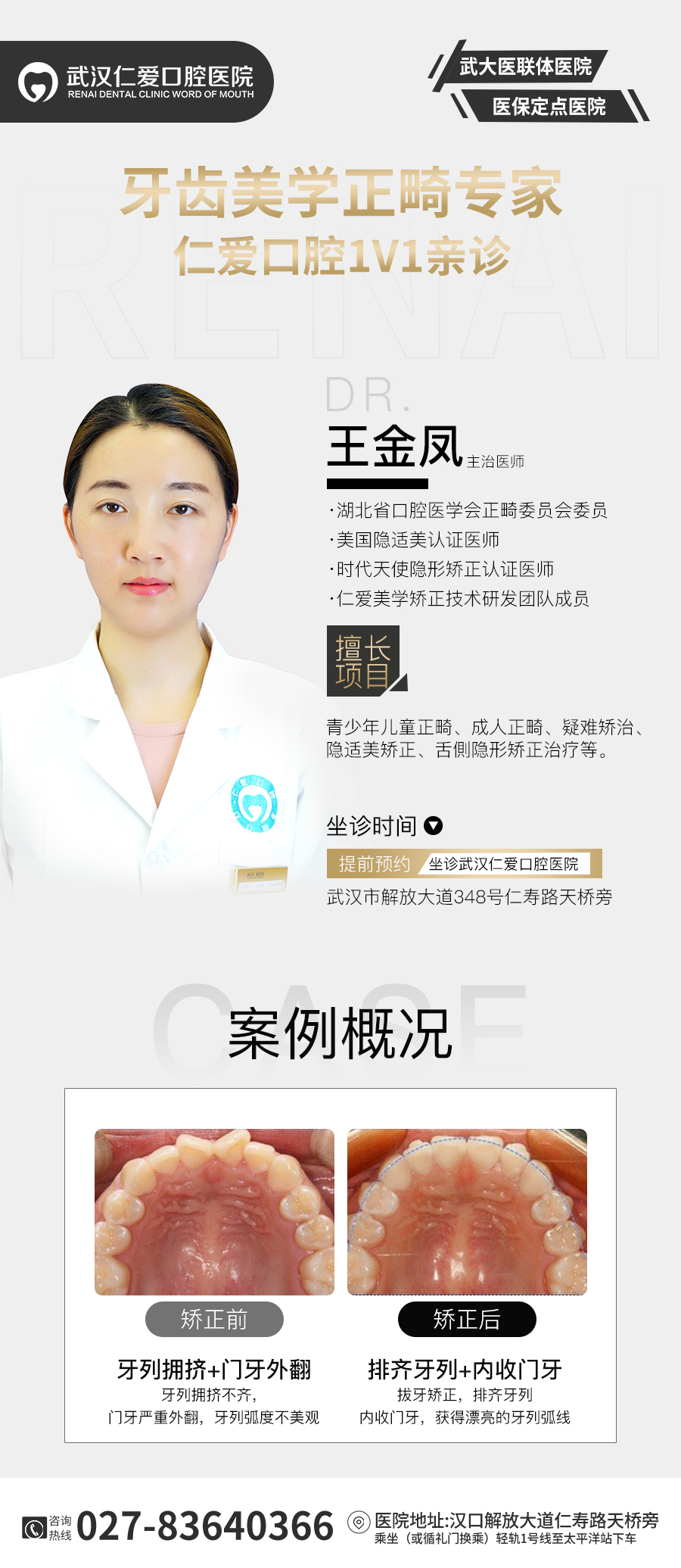 武漢仁愛口腔:00后小姐姐隱形矯正后,顏值大改造!