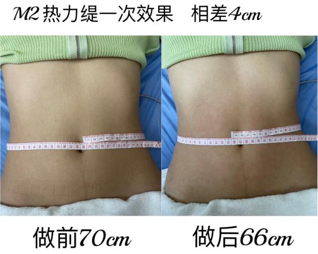 愛美有道,要顏值更要健康,M2熱力緹伴你行