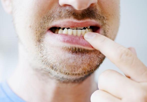 牙齦出血時(shí),不刷牙只漱口可以嗎?牙齦經(jīng)常出血的患者,在日常生活中應(yīng)注意哪些事?