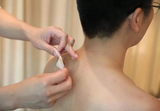 三伏貼干了加什么可以再用?哪里有賣三伏貼?