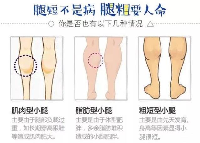吸脂醫生關幾夢:吸脂瘦腿可以解決肥胖腿型嗎?