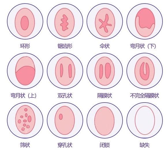 重慶哪家私密整形醫院做處女膜修復專業?