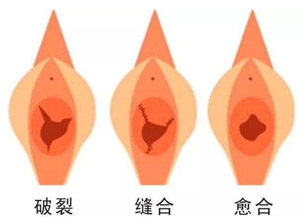重慶哪家私密整形醫院做處女膜修復專業?