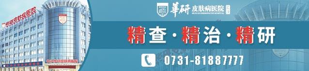 在長(zhǎng)沙華研白癜風(fēng)醫(yī)院治白癜風(fēng)貴嗎
