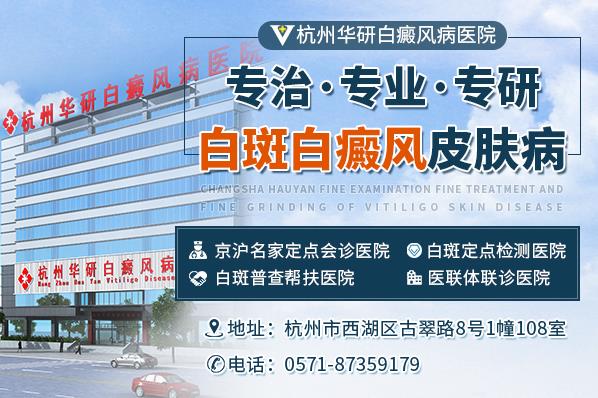 杭州華研白癜風醫(yī)院治療的好嗎?