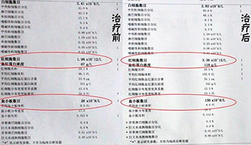 濟南血液病醫院專家如何?平均40余年臨床經驗,一對一精準診療