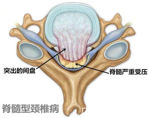 重慶頸椎病骨科醫院哪家好?重慶紅樓醫院正規公辦醫院