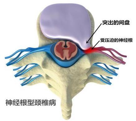 重慶頸椎病骨科醫院哪家好?重慶紅樓醫院正規公辦醫院