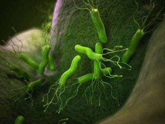 幽門螺桿菌陽性是不是就代表胃癌?幽門螺旋桿菌為什么是致癌物