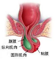 瀘州東大肛腸醫院收費貴嗎 誠信醫療收費正規