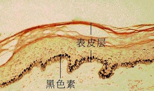 長沙華山皮膚病醫院正規嗎?專業正規杜絕亂收費