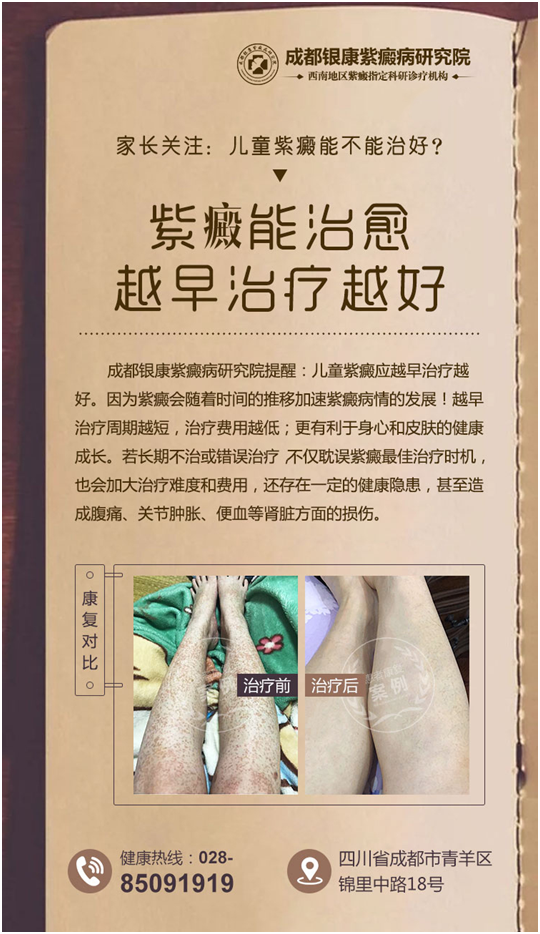 過敏性紫癜能治愈嗎?成都紫癜醫院排名最佳
