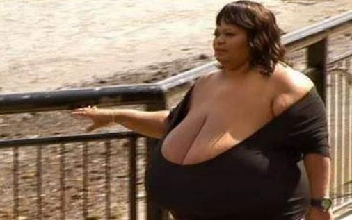 世界上最大的天然乳房 安妮·霍金斯·特納雙乳重達38.5公斤
