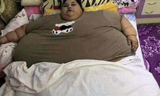 世界上最胖的人 725公斤蘇珊娜·埃曼自認為是個大美女