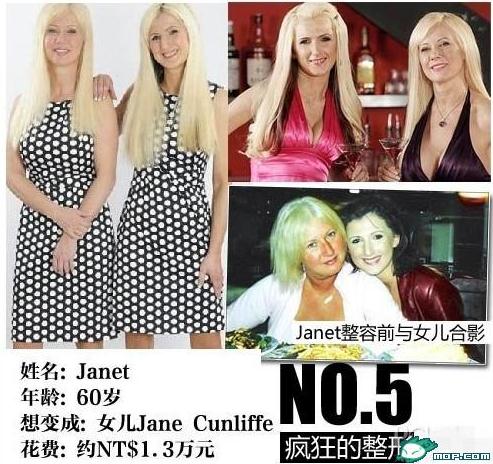 坑爹時(shí)代:那些奇葩的瘋狂變臉整容,坑爹呀