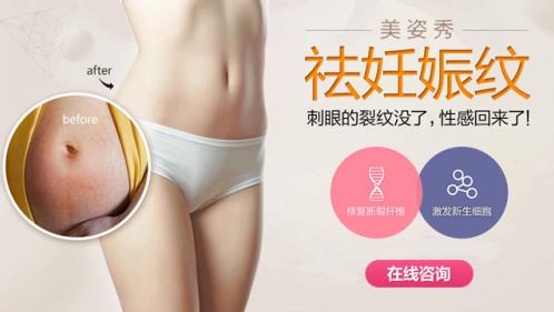 怎么樣能消除妊娠紋,輕松恢復(fù)如初的妙招