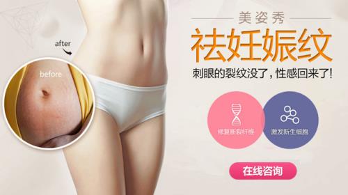 長了妊娠紋還能去掉嗎,祛妊娠紋方法大百科