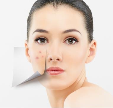 臉上長(zhǎng)痘痘是什么原因?臉上長(zhǎng)痘痘怎么調(diào)理?青春痘怎么消除