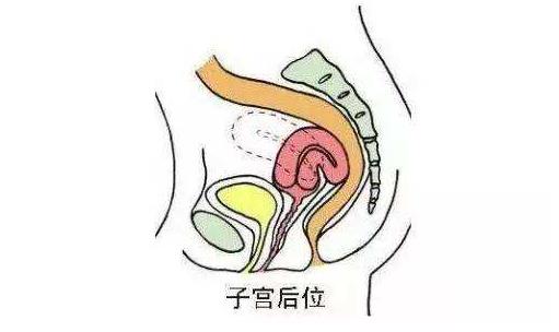 女性子宮后位影響受孕嗎 子宮后位懷孕的4個要點
