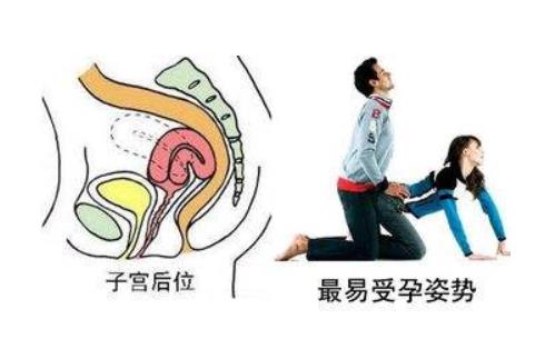 女性子宮后位影響受孕嗎 子宮后位懷孕的4個要點