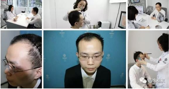 在深圳青逸植發醫院舉辦的實力青逸,技術“植”播圓滿成功