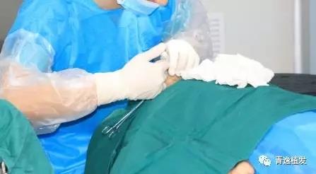 在深圳青逸植發醫院舉辦的實力青逸,技術“植”播圓滿成功