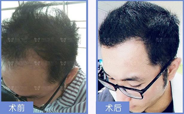 品質見證,“植”擊精彩 2019韓妃首屆發友會圓滿落幕!